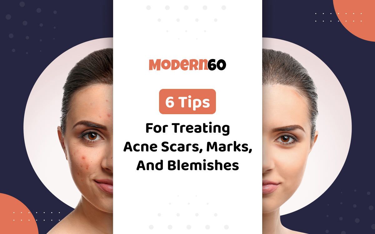 6-Tips-for-Treating-Acne-Scars,-Marks,-and-Blemishes