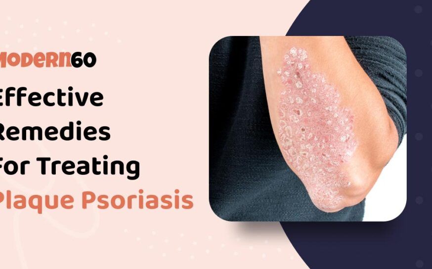 Plaque Psoriasis: Remedies To Effectively Treat It