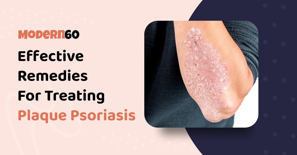Plaque Psoriasis: Remedies To Effectively Treat It