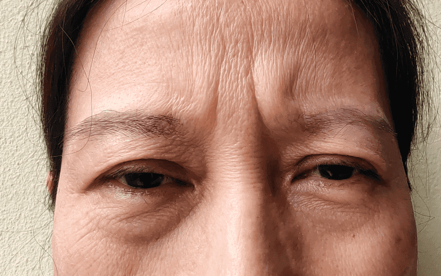 How to Prevent Wrinkles: Tips for Your 60s
