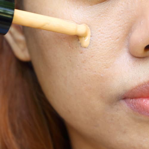 Large Pores and Foundation