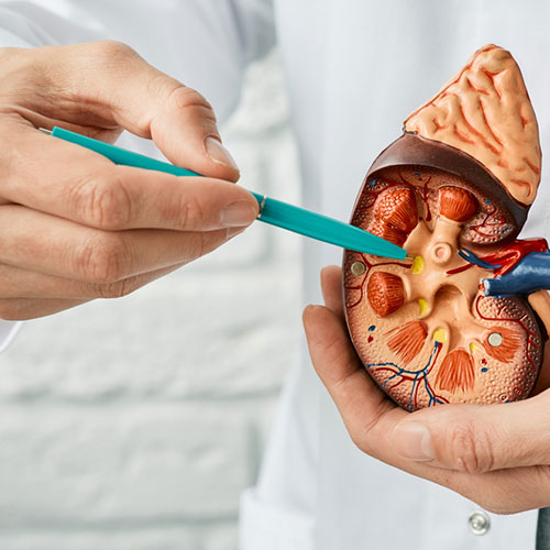 Doctor holding the Kidney's Dummy