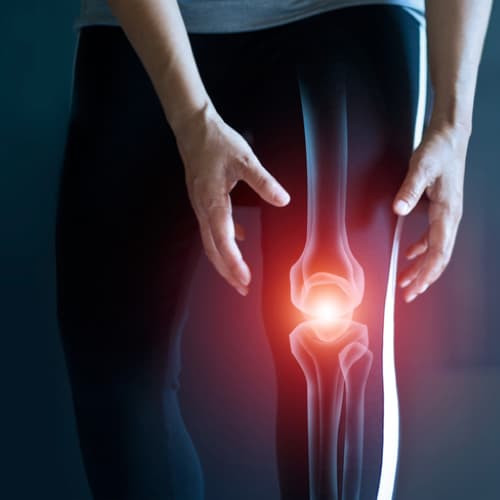 Osteoarthritis