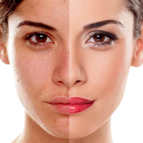 The "No-makeup" makeup look