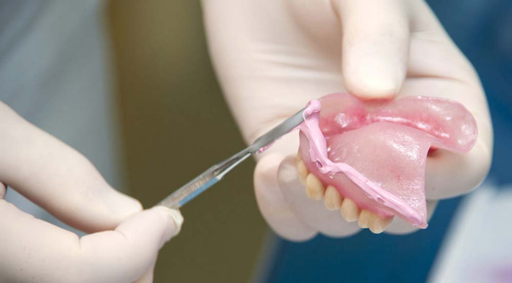 Getting the denture relined