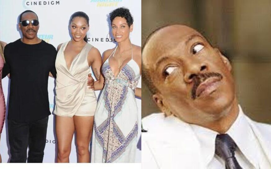 Eddie Murphy Does THIS to Look Years Younger!