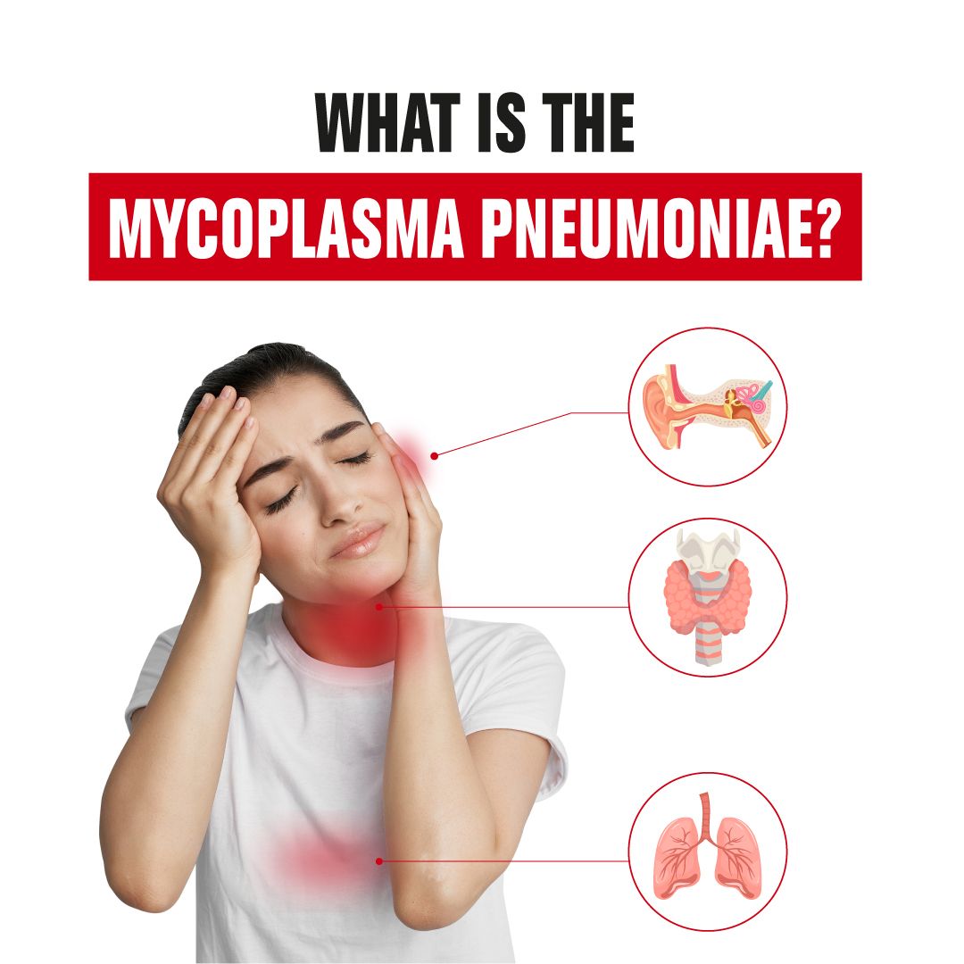 Mycoplasma pneumonia
